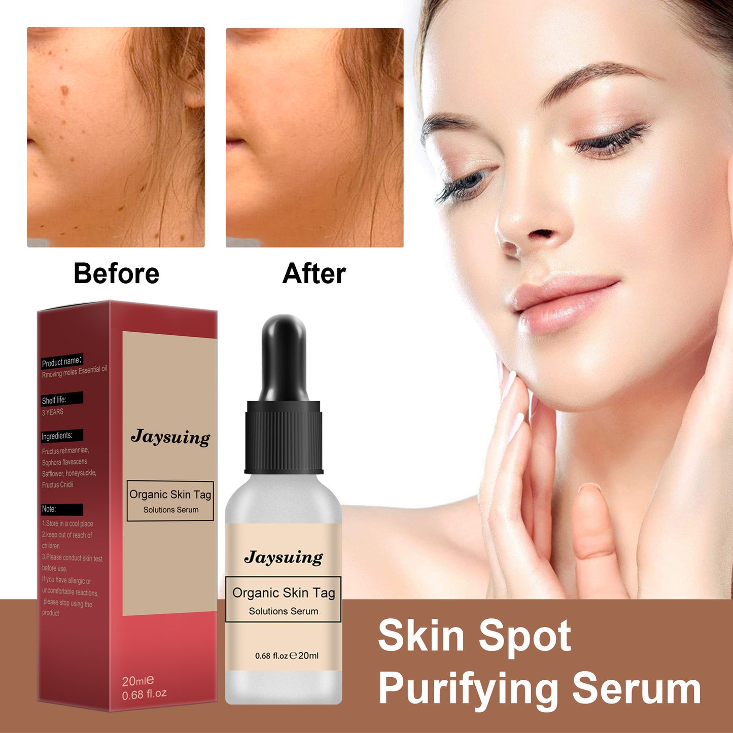 Anti-mole Potion Repair Smooth Skin Wart Care